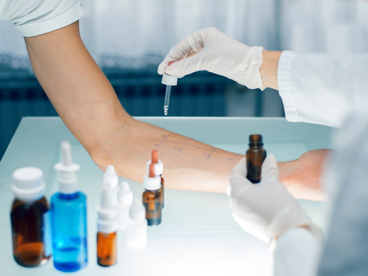What to Expect with Allergy Testing