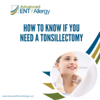 tonsillectomy
